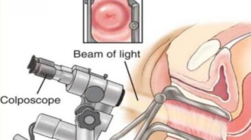 kolposkopi fiyatları 2020