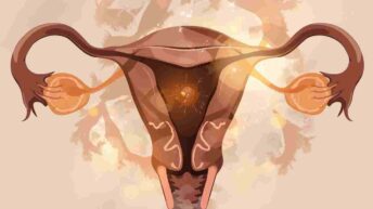 Çikolata Kisti Nedir Belirtileri Nelerdir Çikolata Kisti Hamileliğe Engel Mi Ameliyat Şart Mı